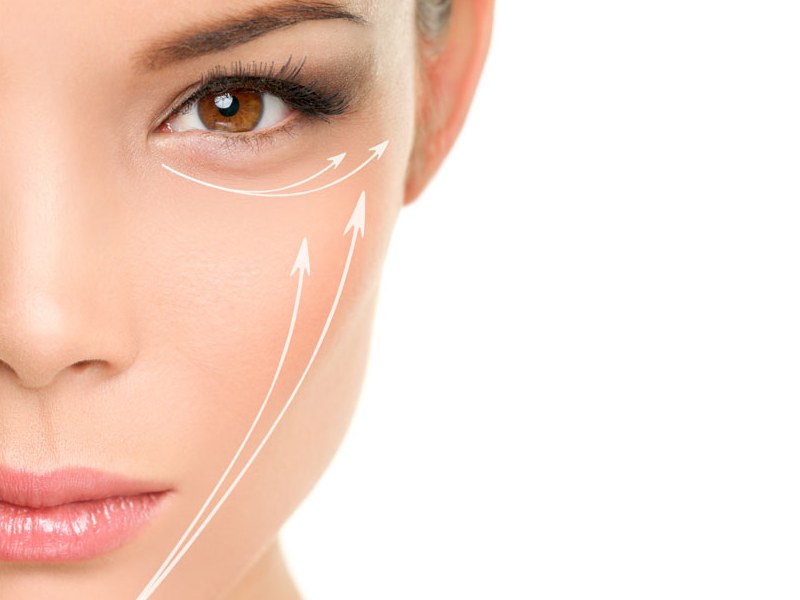 New methods of non-invasive face and body lifts